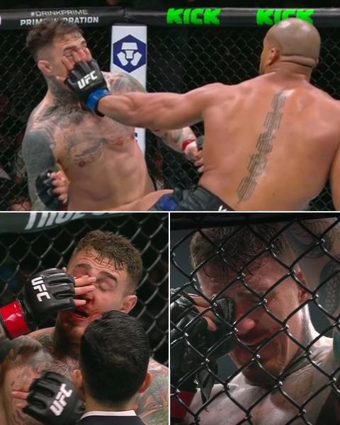 «Драться с одним глазом – обычное дело». Чемпиона UFC захейтили за снятие с титульника